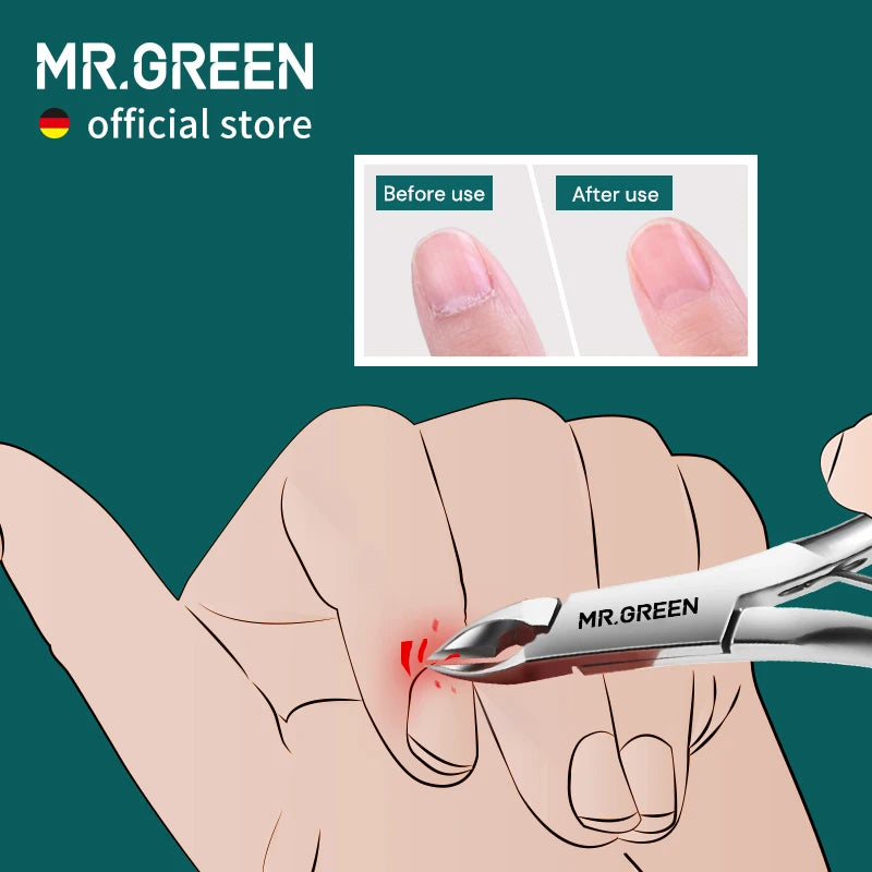 MR.GREEN Cuticle Nippers Nail Manicure Cuticle