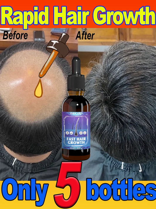 Essential oil promotes rapid hair growth