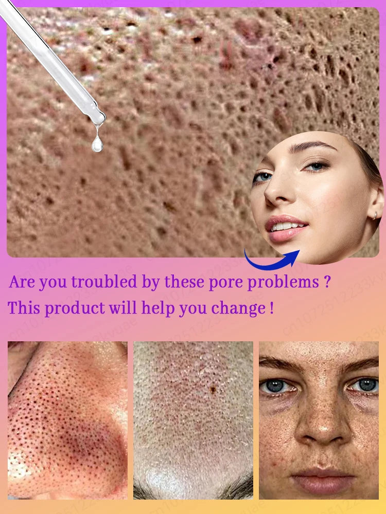 pores remover