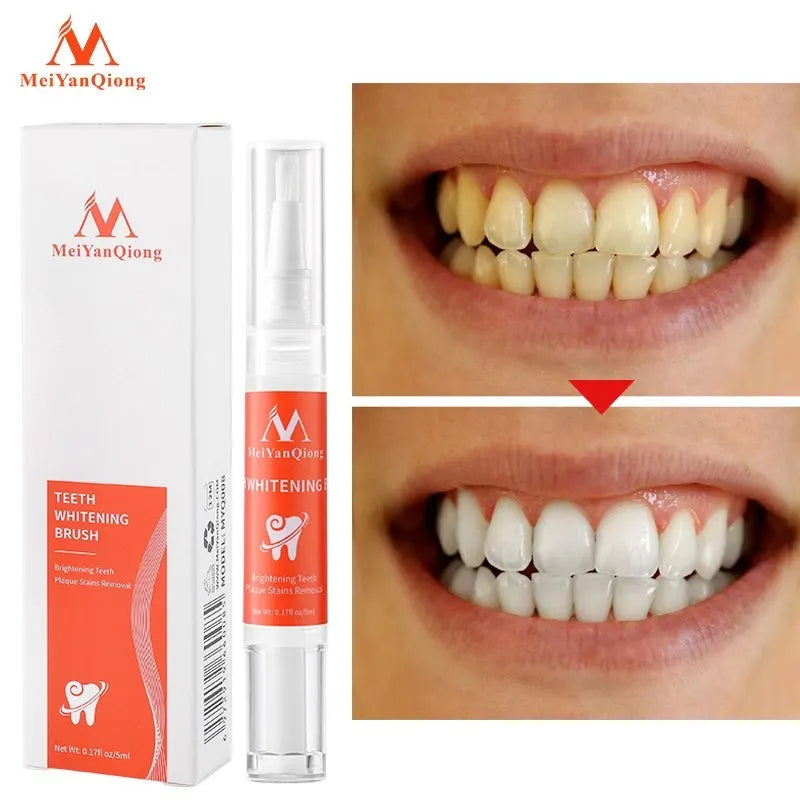 Teeth Whitening Pen Remove Plaque And Tartar