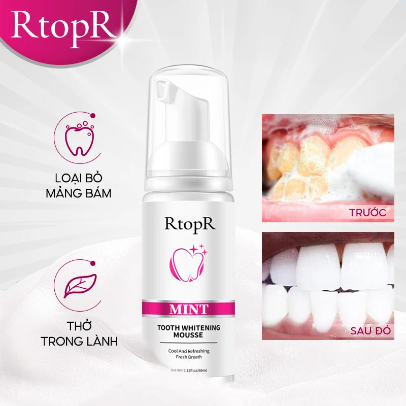 RtopR Teeth Whitening Mousse Removes Stains