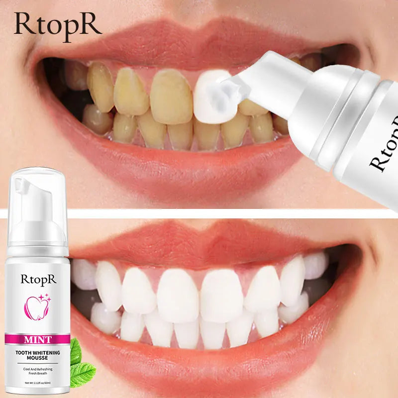 RtopR Teeth Whitening Mousse Removes Stains