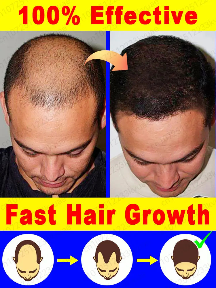 Fast Hair Growth Essence Oil Products