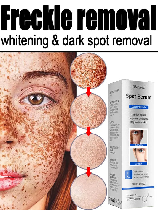 Freckle Removal Whitening Essence Liquid