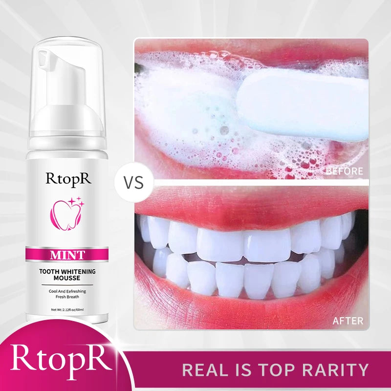 RtopR Mint Tooth Whitenging Mousse Oral