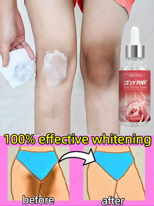 Whitening Cream Private Parts