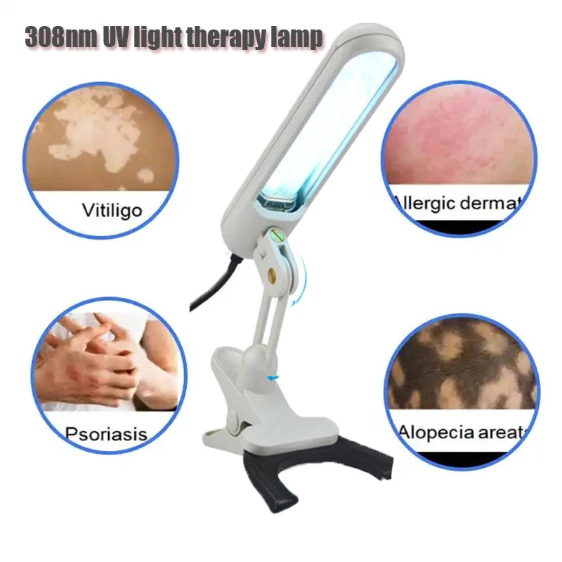 311nm Uv Light Therapy Lamp