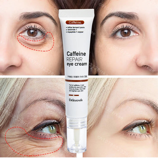 Eye cream removes eye bags puffiness dark circles