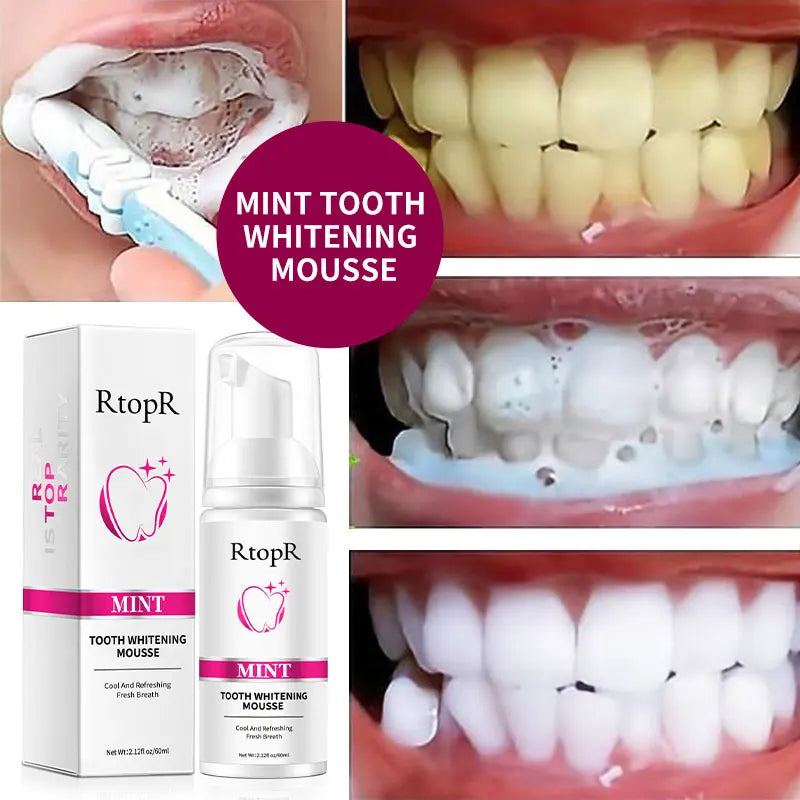 RtopR Mint Tooth Whitenging Mousse Oral