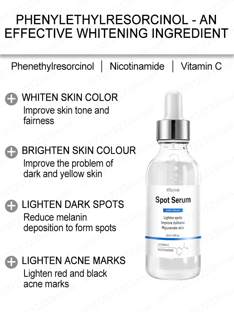 Freckle Removal Whitening Essence Liquid