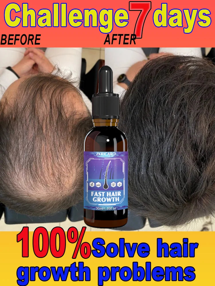 Essential oil promotes rapid hair growth