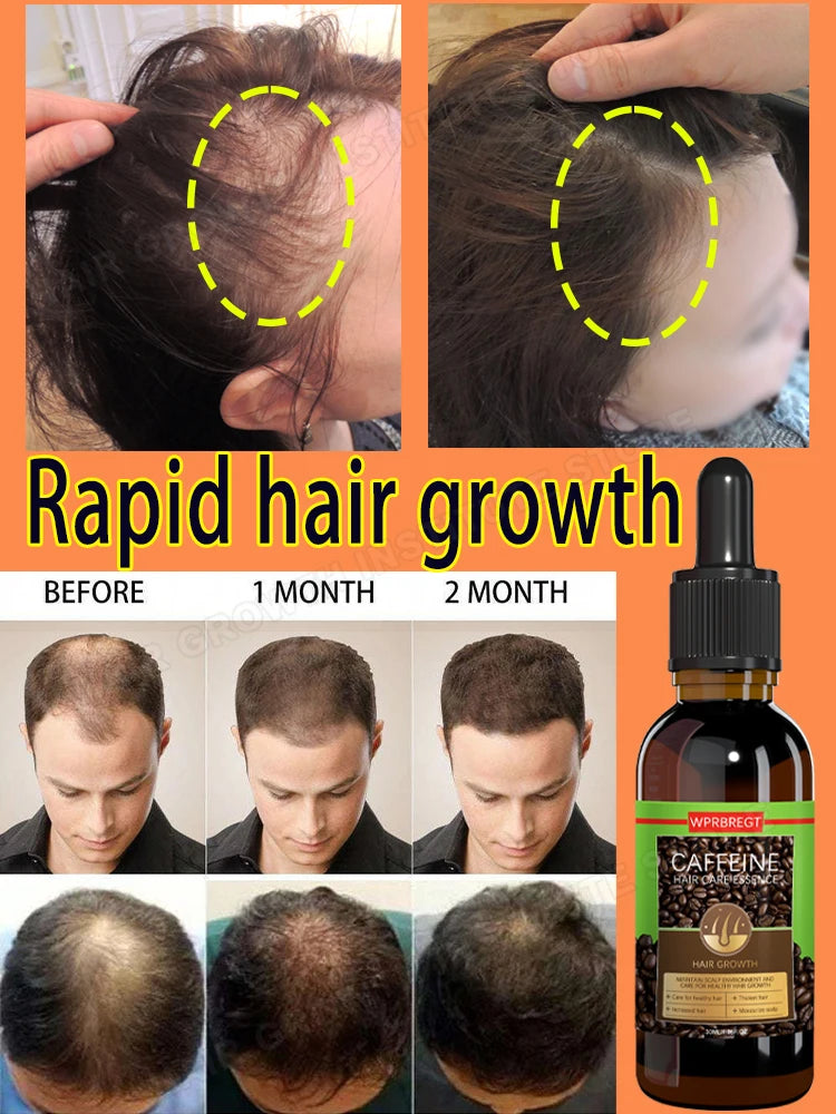 Best-selling global anti-hair loss men's and women's hair growth